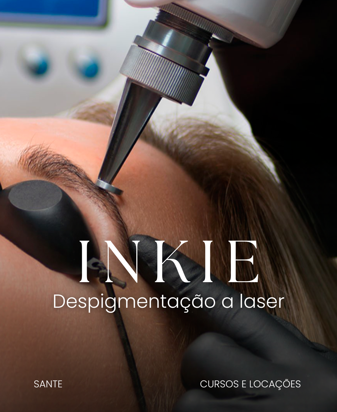 Despigmentação a laser INKIE